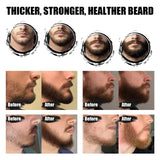 Beard Growth Kit Beard Hair Enhancer